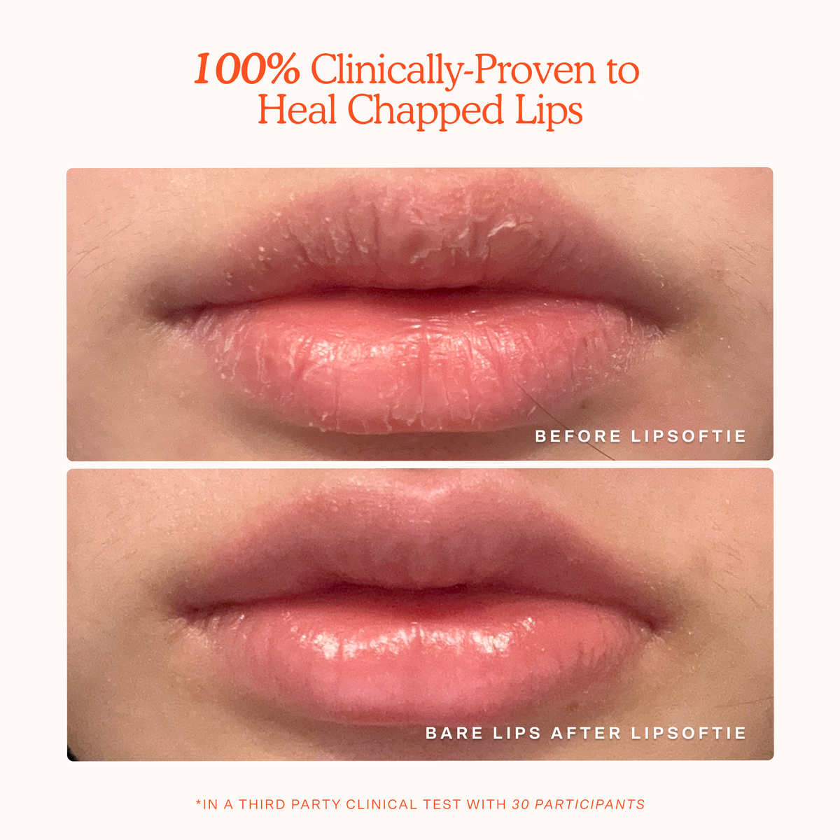 Tower 28 LipSoftie Lip Treatment